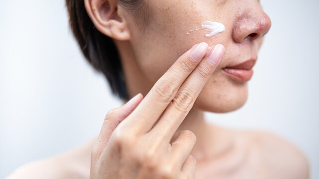 Close-up of asian female applying white moisturizing cream to their face. Natural skin texture with freckles on a white background. Ideal for skincare and beauty routines.