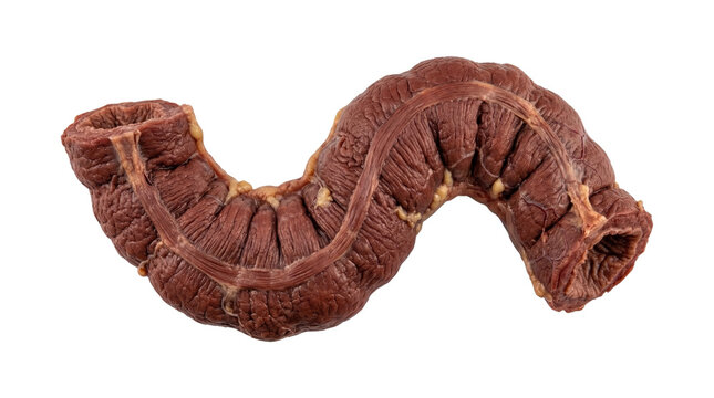 Human sigmoid colon anatomical specimen isolated on white background PNG