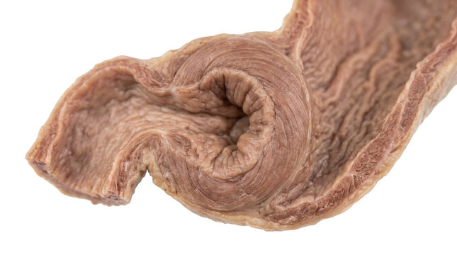 Human pyloric sphincter anatomical specimen isolated on white background PNG