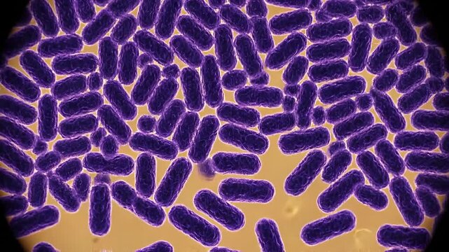 Microscopic view of bacteria with elongated shapes and distinct purple coloration against an orange background, highlighting cellular structure