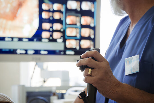 Doctor looking at monitior during gastroscopy procedure, examining upper digestive tract.
