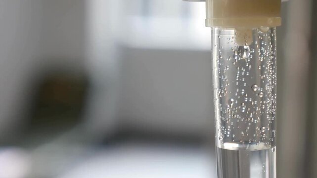 Medical Concept saline IV drip dropper at clinic emergency medicine saline hospital room sick drops therapy treatment patient chemotherapy healthcare