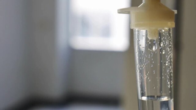 iv drip drops into the patient's room Closeup Saline solution or NSS fluid from IV bag NSS iv dripping tube infusion pumping in hospital chemotherapy