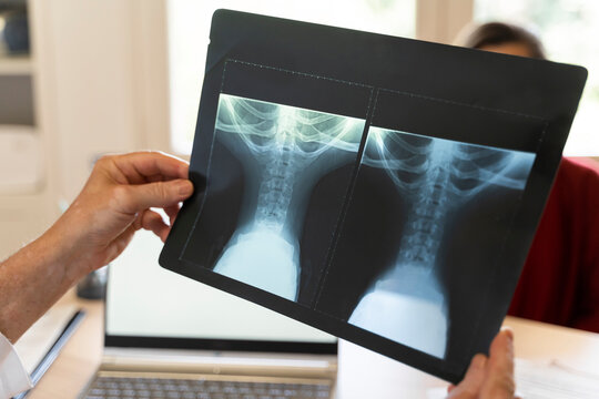 Doctor's hand holding medical x-ray in hand