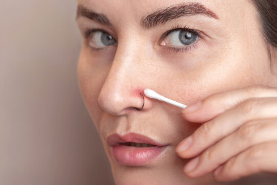 Inflamed nose piercing. Caucasian woman swabbing the piercing site with chlorhexidine on a cotton swab. Post piercing care. Close up photo