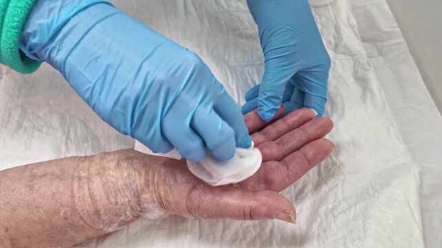Nurse Cleaning Surgical Scar on Senior Woman Hand with Gauze