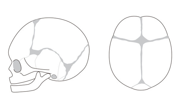 Infant skull anatomy diagram showing cranial sutures and fontanelle, top and side view