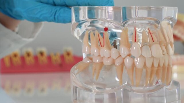 Anatomical model of a human jaw with teeth for a dentist with caries, dental crowns, a dental implant close-up on a light surface and doctor shows bite problems with dental probe and mirror