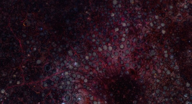 Microscopic examination revealing plentiful pigment cells with melanin granules and blood vessels in choroid stroma