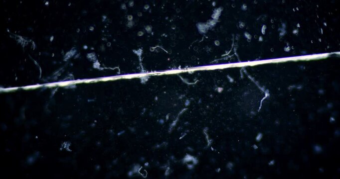 Darkfield Microscopy of Live Microorganisms Moving Fast across Slide with Stationary Algae for Microbiological Research and Exploration of Hidden Ecosystems in Water Samples and Environmental Study