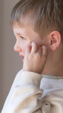 Boy scratching cheek in profile shows rash and irritation. Itch symptom connected to allergy and atopic dermatitis causing redness and discomfort on sensitive child skin. Parvovirus b19 and erythema