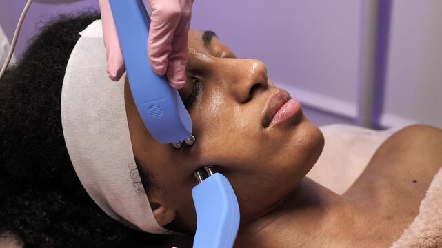 Extreme close up of microcurrent electrodes on African American woman's face. Professional lifting procedure for skin tightening and rejuvenation.