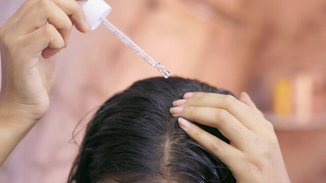 Close up shot of a female applying hair growth serum with a dropper on her scalp at home.