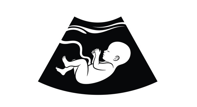 Ultrasound image depicting a fetal position in the womb silhouette