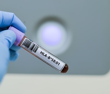 Blood sample tube for HLA-B*58:01 test analysis.