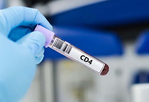 Blood sample tube for CD4 test analysis.