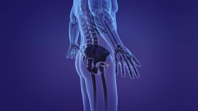 Animation of a painful pelvic girdle