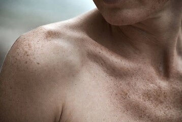 Naklejka premium Close-up of a man's shoulder and neck, displaying sunspots.