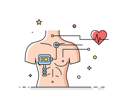 Smart health implant monitoring system featuring a torso outline with a small embedded device icon and a heart symbol connected by thin data lines, expressing