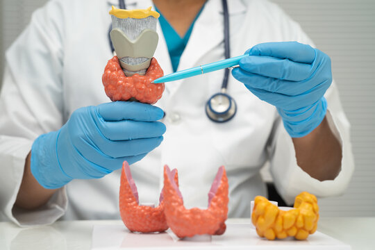 Hyperthyroidism, Overactive Thyroid, Thyroid Lymphoma, Asian doctor with thyroid gland human anatomy model in hospital.