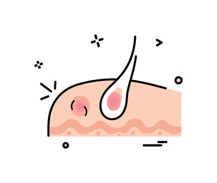 Minor contusion close up showing a rounded skin surface with a subtle gradient bruise and small impact lines nearby, symbolizing tenderness after a bump. The