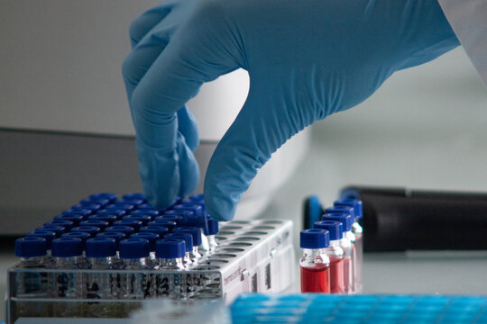 Pr&eacute;paratifs avant l'exp&eacute;rience