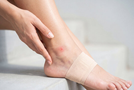 Woman touching her painful injured ankle with a bandage on her foot