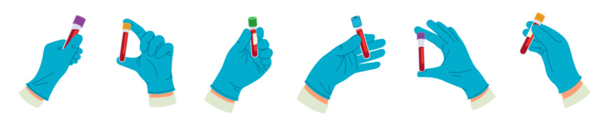 Set of hands of lab worker holding blood samples. Medical worker holds test tubes with blood for testing and examining patient. Flat vector illustration collection isolated on background