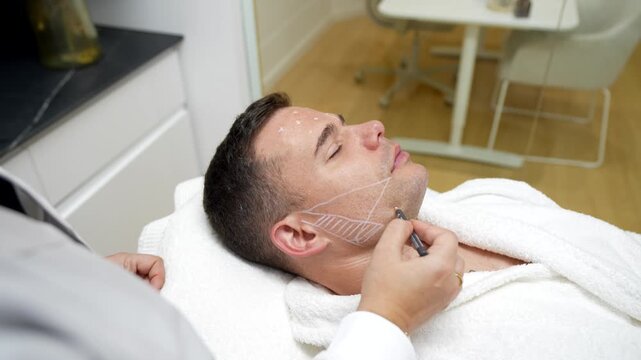 Professional cosmetologist drawing guidelines on a male patient's face before a cosmetic procedure, preparing for a botulinum toxin injection or plastic surgery in a modern aesthetic clinic