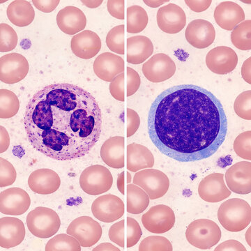 Neutrophil and Lymphocyte Blood Smear Comparison