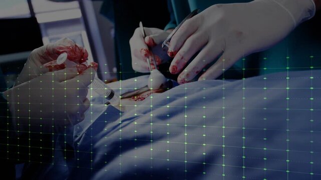 Vertical video: Surgeon holding mass, using tool; nurse suctioning, stopping bleeding; ECG pulsing