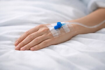 Fototapeta premium Medical IV drip connected to patient hand showing blue connector on sterile white bed sheets