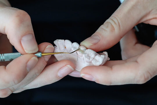 macro shot focusing on a fine brush applying material to a small ceramic inlay within a plaster tooth model in a laboratory. professional dental artistry.