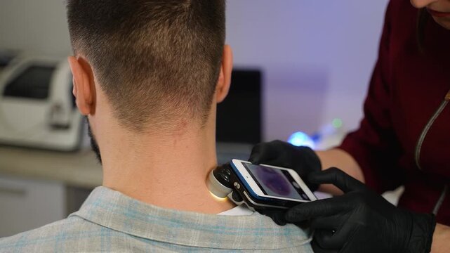 Dermatologist examining patient's moles with a dermatoscope