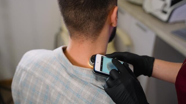 Dermatologist examining patient's mole with smartphone dermatoscope