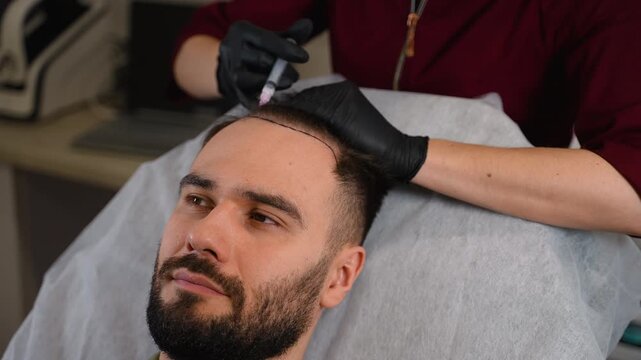 Trichologist injecting patient scalp with mesotherapy treatment