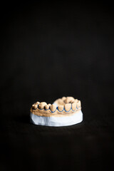 Dental plaster jaw model showing upper and lower teeth on black background illustrating anatomical structure orthodontic study model and professional dentistry education concept © Anton