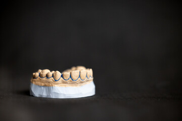 Plaster dental jaw model with upper and lower arches on black background showing tooth anatomy orthodontic training model and professional dentistry study reference concept Description 199 © Anton