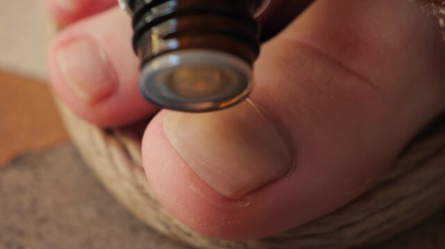 A close-up a cotton applicator gently applying antifungal treatment to a toenail. Concept of personal hygiene, foot care, and the treatment of fungal infections. High quality 4k footage