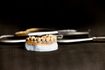 Dental plaster upper jaw model displayed on dark background illustrating tooth anatomy orthodontic study and professional dentistry training with blurred instruments © Anton