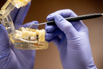 Transparent upper and lower jaw typodont held with dental spoon by dentist showing orthodontic procedure educational workflow and clinical dentistry training setup © Anton