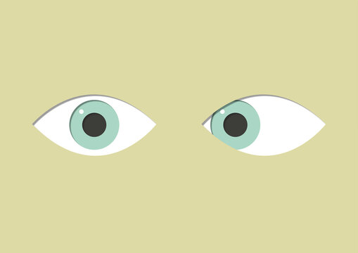 Strabismus, illustration