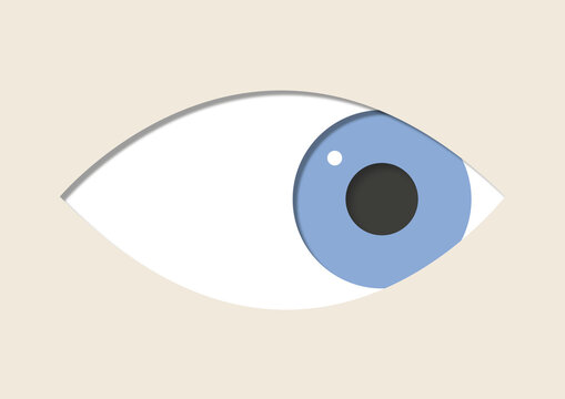 Strabismus, illustration