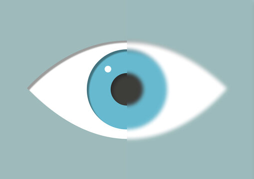Blurry vision, illustration