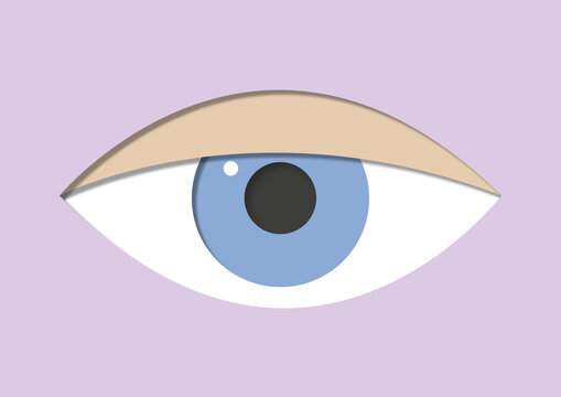 Drooping eyelid, illustration