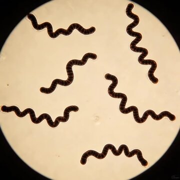 Helicobacter pylori under a microscope has a clearly defined spiral shape.