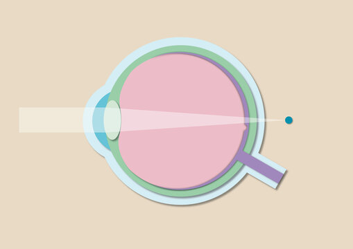 Far-sightedness, illustration