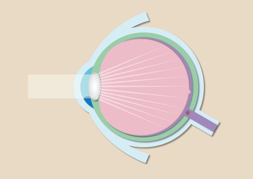 High eye pressure, conceptual illustration