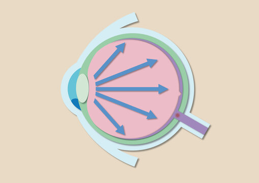 High eye pressure, conceptual illustration