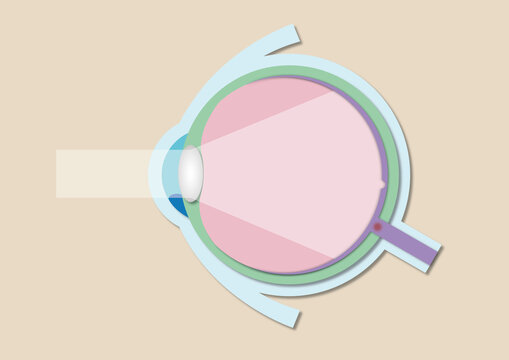 High eye pressure, conceptual illustration